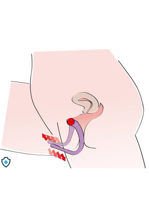 Rozszerzacz waginalny ze stymulacją punktu G