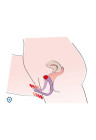 Rozszerzacz waginalny ze stymulacją punktu G